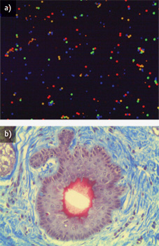 FIGURE 1. (a) Fluorescent microspheres ranging in size from 3 to 5 &mu;m were imaged using a Mitutoyo plan apochromat infinity-corrected long working distance 5X objective, and (b) a dermal skin cell with a trichrome stain was imaged with a 20X version of the same objective.