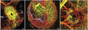 The new imaging tool, which combines multiphoton laser-scanning microscopy (MPLSM) and optical frequency domain imaging (OFDI), reveals strikingly different networks of blood vessels surrounding different types of tumors in a mouse model. Left: Breast cancer in the breast. Middle: Metastatic breast cancer in the brain. Right: Ectopic breast cancer in the skin.