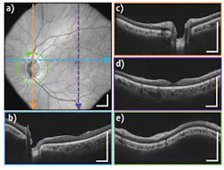 1401bowbreakf2 1401bowbreakf2