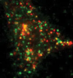 FIGURE 4. This total internal reflection fluorescence (TIRF) micrograph shows single GFP-labeled syntaxin molecules (green) and insulin-containing granules (red) in a pancreatic beta-cell. FIGURE 4. This total internal reflection fluorescence (TIRF) micrograph shows single GFP-labeled syntaxin molecules (green) and insulin-containing granules (red) in a pancreatic beta-cell.