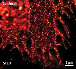 FIGURE 3. Stimulated emission depletion, or STED, super-resolution microscopy provides far higher resolution than confocal microscopy to image single cells. FIGURE 3. Stimulated emission depletion, or STED, super-resolution microscopy provides far higher resolution than confocal microscopy to image single cells.