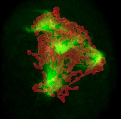 Content Dam Bow Online Articles 2013 08 Tumorzelle Web