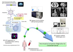 Content Dam Bow Online Articles 2014 07 Liquid Biopsy Web Content Dam Bow Online Articles 2014 07 Liquid Biopsy Web