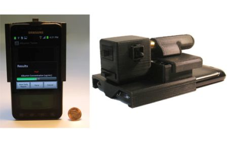 Content Dam Bow Online Articles 2015 August 247974 Albumintester Ozcan Web