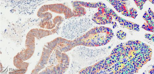 Content Dam Bow Online Articles 2015 September Datacolor Flagship Tissue Analysis Web