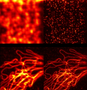 Confocal microscopy (left) is compared with STED microscopy using a Mobius Photonics laser source (right) for two different cases. In both instances, STED results in a far higher resolution.