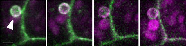 Live human embryonic kidney cells labeled with CLIP-tags (magenta) and SNAP-tags (green) are imaged using two-color STED microscopy. The scale bar is 1 micron.