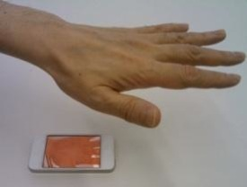 Content Dam Lfw Online Articles 2012 08 Hand Veins