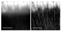 Confocal light-sheet microscopy is sharper way to view the brain's neural network Confocal light-sheet microscopy is sharper way to view the brain's neural network