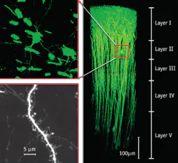 FIGURE 1. The Olympus Fluoview FV1000-MPE multiphoton system with a 60x objective can capture cross-sectional images down to 700 μm from the surface, as shown in these three-dimensionally constructed images of neurons expressing EYFP in the cerebral neocortex of a mouse under anesthesia. FIGURE 1. The Olympus Fluoview FV1000-MPE multiphoton system with a 60x objective can capture cross-sectional images down to 700 μm from the surface, as shown in these three-dimensionally constructed images of neurons expressing EYFP in the cerebral neocortex of a mouse under anesthesia.