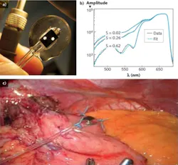 FIGURE 3. The fiberoptic probe (a) is sewn into an internal organ (b) in preparation for an experiment in which oxygen supply is eliminated from a portion of tissue being removed. The probe yields spectroscopic analysis on the reflectance spectrum (c) that shows the ischemic injury as tissue is deprived of oxygen (S, saturation = 0.62 for baseline to 0.02 for hypoxic). FIGURE 3. The fiberoptic probe (a) is sewn into an internal organ (b) in preparation for an experiment in which oxygen supply is eliminated from a portion of tissue being removed. The probe yields spectroscopic analysis on the reflectance spectrum (c) that shows the ischemic injury as tissue is deprived of oxygen (S, saturation = 0.62 for baseline to 0.02 for hypoxic).