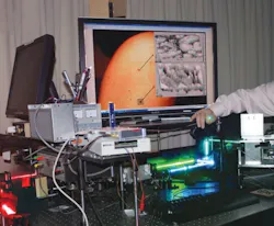 FIGURE 4. The fiber-optic probe in the biomedical optics lab at Oregon Health & Science University (in hand). The blue and green lasers feed a multimodal confocal microscope that mimics hematoxylin and eosin (H&E) histology. The red laser is a line-scanning microscope. The computer display shows the pattern of nevus (top) versus melanoma (bottom). FIGURE 4. The fiber-optic probe in the biomedical optics lab at Oregon Health & Science University (in hand). The blue and green lasers feed a multimodal confocal microscope that mimics hematoxylin and eosin (H&E) histology. The red laser is a line-scanning microscope. The computer display shows the pattern of nevus (top) versus melanoma (bottom).