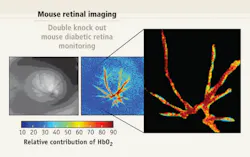 FIGURE 2. Clinicians can use hyperspectral imaging also to measure the percentage of oxyhemoglobin within retinal microvasculature. Here, the technique imaged the retina of a mouse genetically predisposed to developing diabetic retinopathy. FIGURE 2. Clinicians can use hyperspectral imaging also to measure the percentage of oxyhemoglobin within retinal microvasculature. Here, the technique imaged the retina of a mouse genetically predisposed to developing diabetic retinopathy.