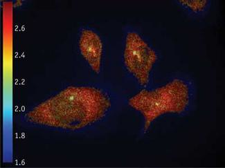 FIGURE 1. Cells are labeled with Alexa488 and Alexa568 in a fluorescence-lifetime image, merged with intensity in grayscale, obtained using the LIFA frequency-domain FLIM system. The lifetime of the Alexa488 is shown and a clear decrease is visible where the Alexa488 and Alexa568 are interacting with each other (FRET) at the centrosomes (the microtubule organizing centers inside the cell that are required for cell-cycle progression through G1-S phase).