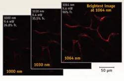 FIGURE 2. These test images using mCherry show how image quality is enhanced as the excitation wavelength is increased. These image slices are of capillaries in an adult mouse ear at a depth of 20 µm and were obtained with a constant power level (9.4 mW) at the sample. FIGURE 2. These test images using mCherry show how image quality is enhanced as the excitation wavelength is increased. These image slices are of capillaries in an adult mouse ear at a depth of 20 µm and were obtained with a constant power level (9.4 mW) at the sample.