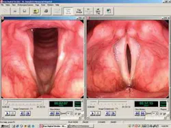 Th 0803bow Fea4f3 Th 0803bow Fea4f3