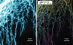 A 2-D fluorescence image (left) of microtubules and the corresponding 3-D STORM image (right), are shown with z coded in color. A 2-D fluorescence image (left) of microtubules and the corresponding 3-D STORM image (right), are shown with z coded in color.