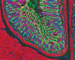 Fluorescent optical filters and dyes make it possible to label specific cells, as seen in this section of a rat’s stomach. Fluorescent optical filters and dyes make it possible to label specific cells, as seen in this section of a rat’s stomach.