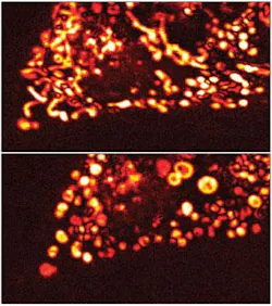 Figure 2. 'Light-induced scattering-around-a-nanoabsorber' (LISNA) microscopy needs no labels to image mitochondria in live cells before (top) and during drug-induced apoptosis (bottom). Figure 2. 'Light-induced scattering-around-a-nanoabsorber' (LISNA) microscopy needs no labels to image mitochondria in live cells before (top) and during drug-induced apoptosis (bottom).