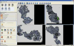 FIGURE 3. With Definiens Tissue Studio, a user can load up to four images at once and interactively train the system to recognize regions of interest. FIGURE 3. With Definiens Tissue Studio, a user can load up to four images at once and interactively train the system to recognize regions of interest.
