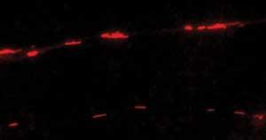 The mitochondria show up here, in two neuronal processes from a Parkinson&rsquo;s disease cybrid cell line, as red rods.