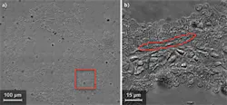 FIGURE 3. A GFM image (a) shows the same biopsy tissue as in Fig. 1. The image is constructed by stitching together 225 individual images (a 15 × 15 array) taken with a 100X/1.4 NA brightfield objective. The gland area (b) is zoomed in to show the basal cell layer, indicating the HGPIN condition. FIGURE 3. A GFM image (a) shows the same biopsy tissue as in Fig. 1. The image is constructed by stitching together 225 individual images (a 15 × 15 array) taken with a 100X/1.4 NA brightfield objective. The gland area (b) is zoomed in to show the basal cell layer, indicating the HGPIN condition.