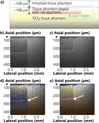 A prepared tissue sample that mimics actual biological tissue embedded with gold nanosphere (GNS) and nanorod (GNR) colorimetric contrast agents (a) is analyzed using conventional OCT imaging for the GNS particles (b) and the GNR particles (c). True-color spectroscopic OCT (SOCT) analysis converts the information into actual colors that reveal the spectral and spatial information for the sample in (d) and (e), respectively.