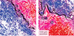 Two examples of NIVI images show the technique's capability for finding tumors and their boundaries. The pixelation in the images comes from undersampling, rather than the optical resolution of the system. The blue color-coded regions have been classified as normal, the red as abnormal (tumor), and the pink as indeterminate. An algorithm automatically computes a black-line boundary based on the NIVI data. Two examples of NIVI images show the technique's capability for finding tumors and their boundaries. The pixelation in the images comes from undersampling, rather than the optical resolution of the system. The blue color-coded regions have been classified as normal, the red as abnormal (tumor), and the pink as indeterminate. An algorithm automatically computes a black-line boundary based on the NIVI data.