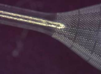 The 25th anniversary of ICALEO will explore the latest developments in laser materials processing and microprocessing, such as the ability of excimer lasers to drill holes in embolic filters that are large enough to allow blood flow but small enough to catch any potentially dangerous debris.