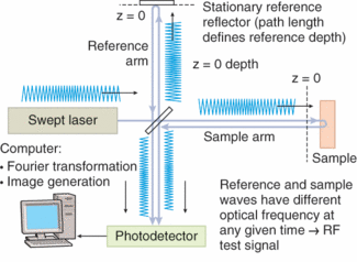 An OCT system developed by MIT researchers scans a 4 &times; 4 mm region of the retina in just 0.87 s with an average depth resolution of 10 to 15 &micro;m.