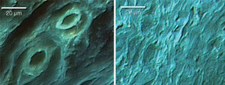 Multispectral imaging autofluorescence microscopy (MIAM) is used to analyze untreated (left) and laser-welded (right) corneal tissue that has been cut using standard surgical procedures. After 60 days of healing, MIAM reveals that the laser-welded cornea is almost fully healed, while the untreated cornea still shows an irregular epithelium and disorganized collagen tissue.