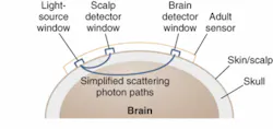 FIGURE 1. CAS Medical’s FORE-SIGHT system projects NIR light into the brain to quantify specific elements found in blood and brain tissue and produce an absolute measurement indicating cerebral-tissue oxygen saturation. FIGURE 1. CAS Medical’s FORE-SIGHT system projects NIR light into the brain to quantify specific elements found in blood and brain tissue and produce an absolute measurement indicating cerebral-tissue oxygen saturation.