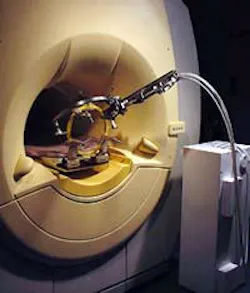 MRC supports installation of the multilaser neurosurgery system in an interventional MRI environment. High-resolution images are taken preoperatively for planning purposes, while lower-resolution images are taken during surgery to monitor progress. MRC supports installation of the multilaser neurosurgery system in an interventional MRI environment. High-resolution images are taken preoperatively for planning purposes, while lower-resolution images are taken during surgery to monitor progress.