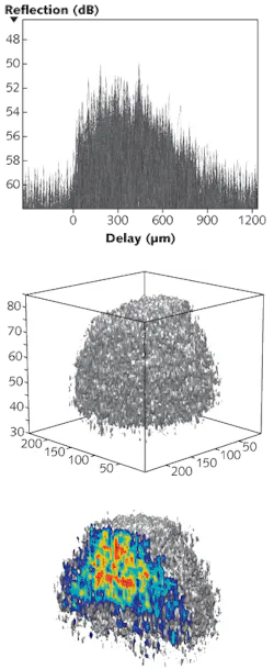 A holographic optical-coherence-imaging (HOCI) technique records depth-resolved photons scattered coherently from a tissue sample in a photorefractive polymer. Here, individual holographic images (top) are stacked to create a three-dimensional (3-D) volumetric representation of an 800-µm-diameter spheroidal rat tumor (center). The tumor can be analyzed as a whole or through a series of vertical cuts (bottom). A holographic optical-coherence-imaging (HOCI) technique records depth-resolved photons scattered coherently from a tissue sample in a photorefractive polymer. Here, individual holographic images (top) are stacked to create a three-dimensional (3-D) volumetric representation of an 800-µm-diameter spheroidal rat tumor (center). The tumor can be analyzed as a whole or through a series of vertical cuts (bottom).