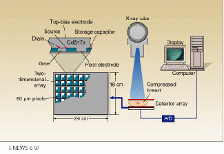 Flat-panel detector arrays of CdZnTe are expected to improve digital mammography by enabling direct digital recording of x-ray images.