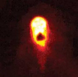 A full image-based feedback system continuously monitors the keyhole welding process to make sure the weld is adequate. A full image-based feedback system continuously monitors the keyhole welding process to make sure the weld is adequate.