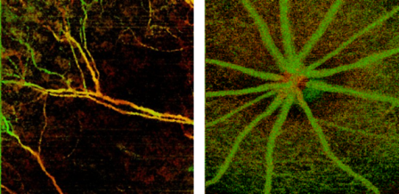 Content Dam Bow Online Articles 2016 03 Angioimage2 2