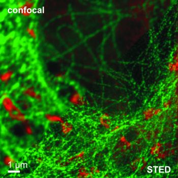 Content Dam Bow Online Articles 2016 03 Pattern Matching Confcoal Sted Web