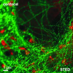 Content Dam Bow Online Articles 2016 03 Pattern Matching Confcoal Sted Web Content Dam Bow Online Articles 2016 03 Pattern Matching Confcoal Sted Web