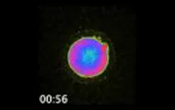 Content Dam Bow Online Articles 2016 05 Ivf Thumb Content Dam Bow Online Articles 2016 05 Ivf Thumb