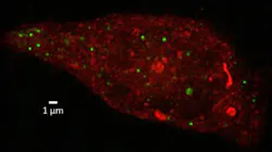 Content Dam Bow Online Articles 2016 05 Medimmune Exosomes Web Content Dam Bow Online Articles 2016 05 Medimmune Exosomes Web