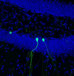 Content Dam Bow Online Articles 2016 05 Newborn Neurons Rv Gfp 40x 2013 Web Content Dam Bow Online Articles 2016 05 Newborn Neurons Rv Gfp 40x 2013 Web