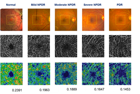 Content Dam Bow Online Articles 2016 10 Picture2 Web