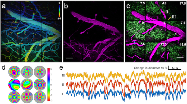 A new type of adaptive-optics (AO) technology for brain research is used here to show corresponding changes in blood vessels and structures called neural dendrites. Each of the three images consists of nine subimages, each created via its own AO subsystem.