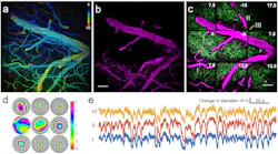 A new type of adaptive-optics (AO) technology for brain research is used here to show corresponding changes in blood vessels and structures called neural dendrites. Each of the three images consists of nine subimages, each created via its own AO subsystem. A new type of adaptive-optics (AO) technology for brain research is used here to show corresponding changes in blood vessels and structures called neural dendrites. Each of the three images consists of nine subimages, each created via its own AO subsystem.