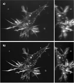 FIGURE 2. Edothelial cells from a mouse aorta captured by the 2P-ISIM microscope without adaptive optics (a), compared to increased resolution with the incorporation of adaptive optics (b). FIGURE 2. Edothelial cells from a mouse aorta captured by the 2P-ISIM microscope without adaptive optics (a), compared to increased resolution with the incorporation of adaptive optics (b).