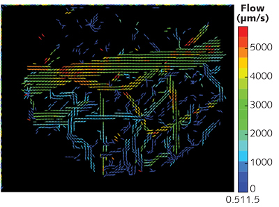 Analysis of high-resolution intravital z-section imagery enables generation of 3D flow maps depicting the microvascular network in a healthy mouse brain; velocity is noted in &mu;m/s.