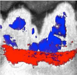 Content Dam Bow Online Articles 2017 09 Photoacoustic Ultrasound Image Content Dam Bow Online Articles 2017 09 Photoacoustic Ultrasound Image