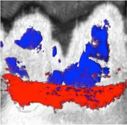 Content Dam Bow Online Articles 2017 09 Photoacoustic Ultrasound Image Content Dam Bow Online Articles 2017 09 Photoacoustic Ultrasound Image