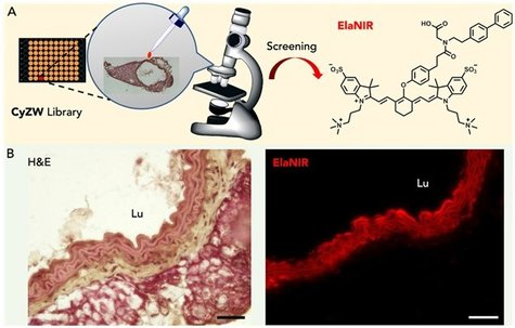 Content Dam Bow Online Articles 2018 04 Rsz Fig1